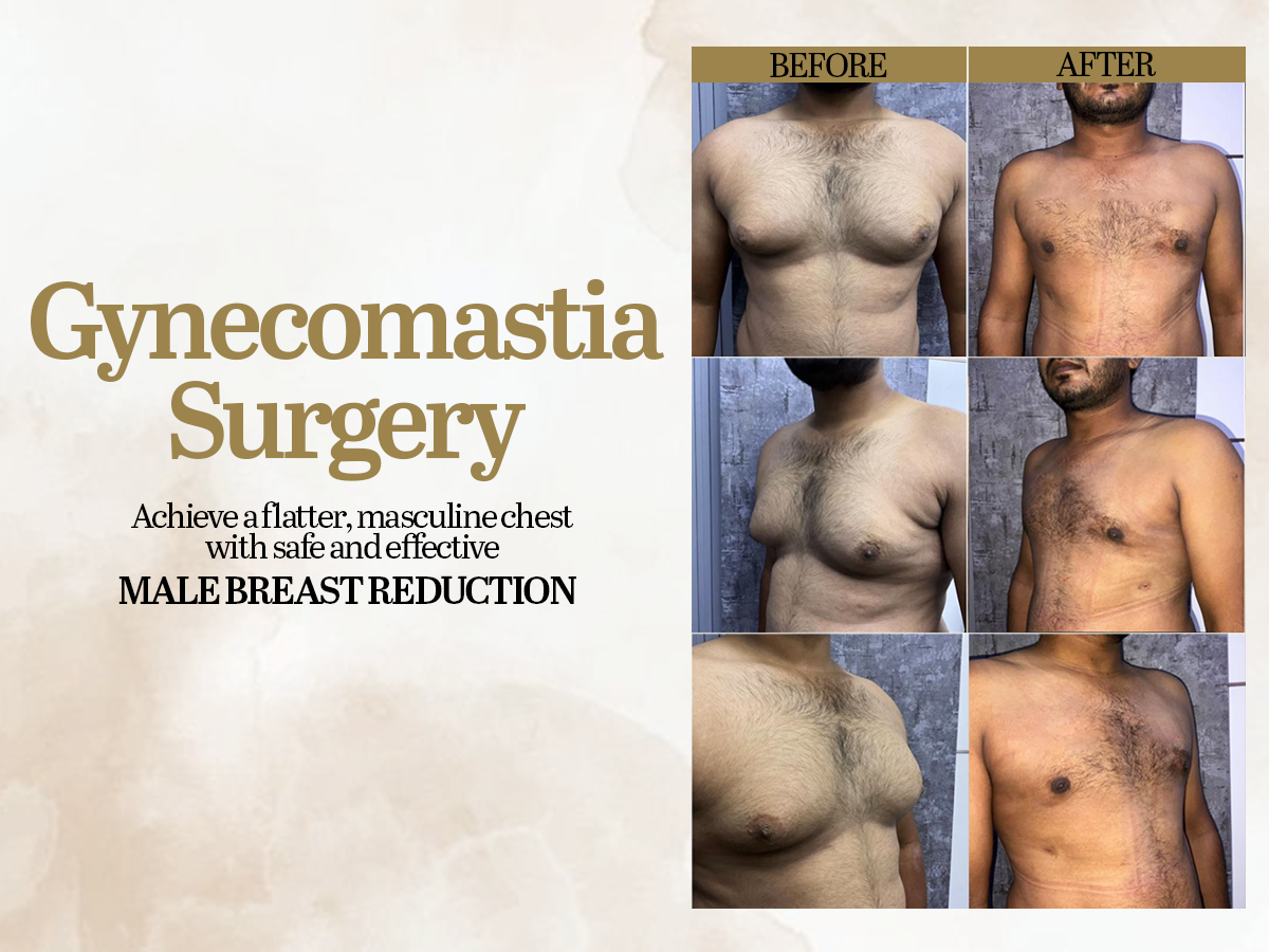 Cosmetic & Plastic Surgeon in Lucknow, Lucknow Plastic Surgery Clinic