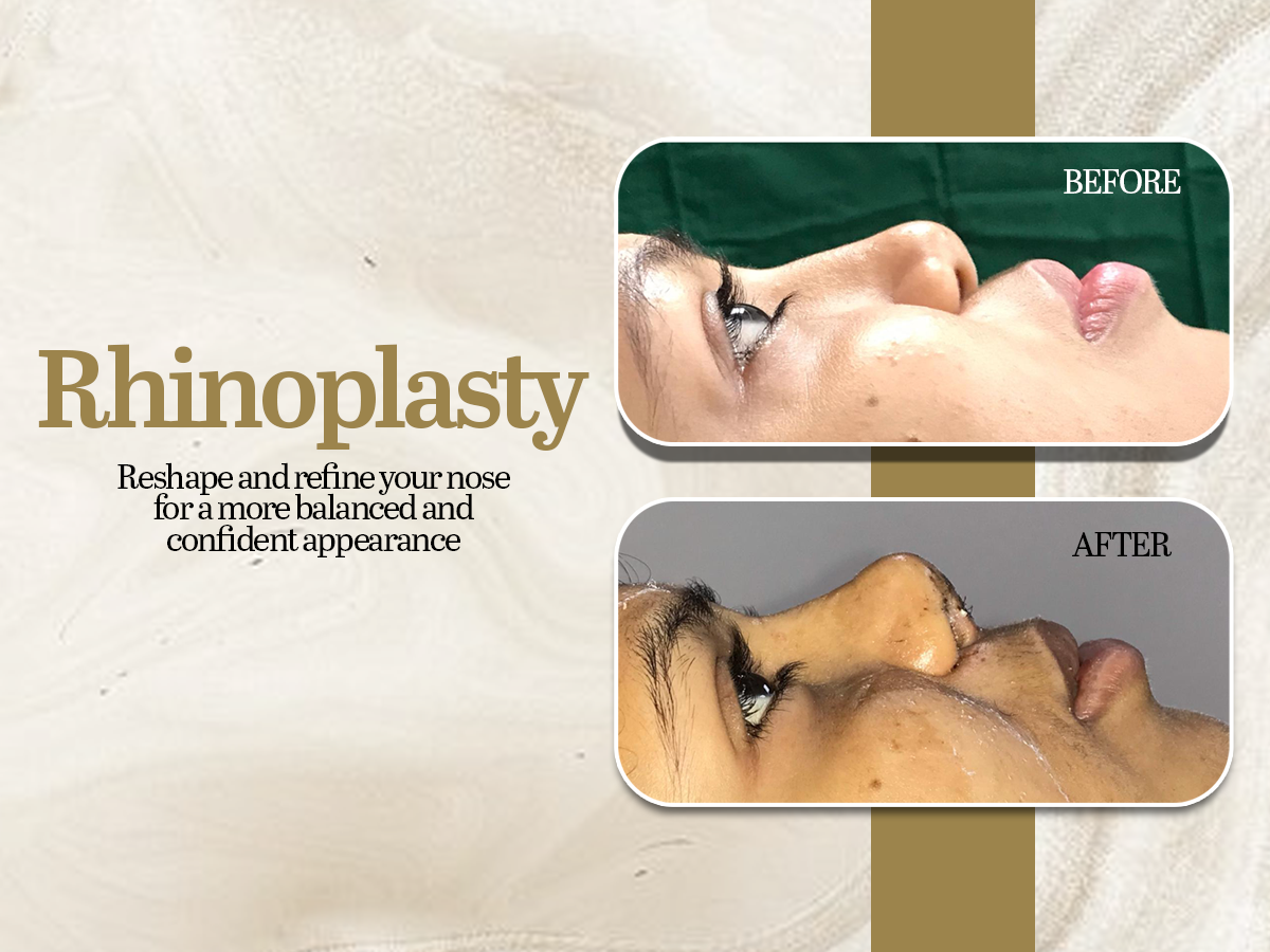 Cosmetic & Plastic Surgeon in Lucknow, Lucknow Plastic Surgery Clinic